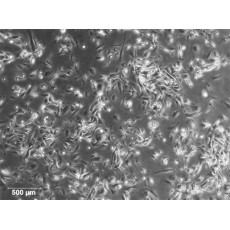 Human Renal Proximal Tubular Epithelial Cells (HRPTEpC)